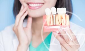 Dental implants are good for bone health.