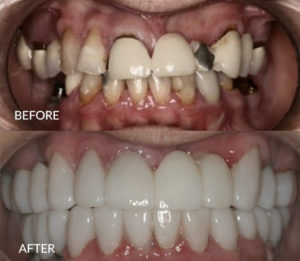 Sherri Before and After