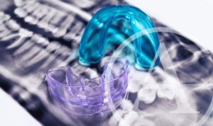 Try a PX3 mouthguard.